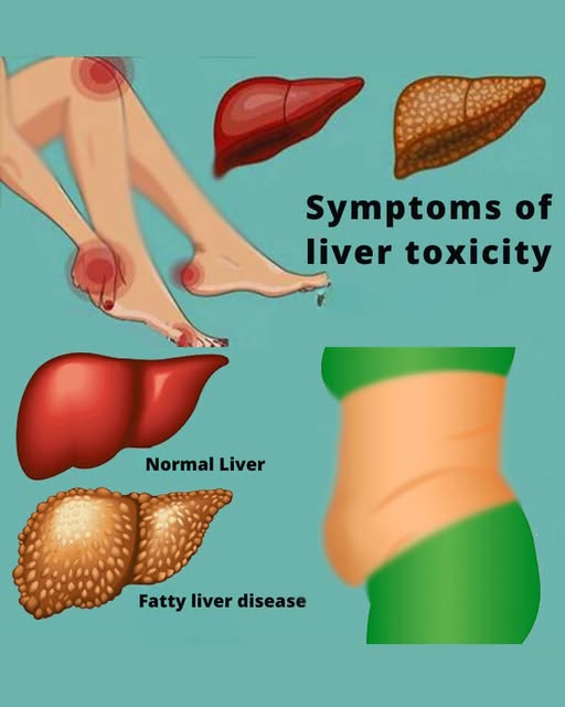 11 Signs Your Liver Is Not Working Well and Toxins Are Building Up in Your Body