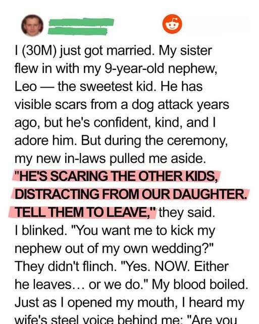 They Told Me To Kick My Scarred Nephew Out Of My Wedding—My Wife Overheard Everything