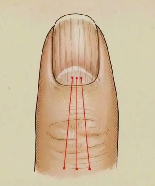 Foods That Help Minimize Nail Ridges: A Guide to Nutrition for Stronger Nails